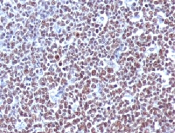 CCNB1 / Cyclin B1 Antibody - IHC testing of FFPE human tonsil with Cyclin B1 antibody (clone BCLB1-1).  This image was taken for the unmodified form of this product. Other forms have not been tested.
