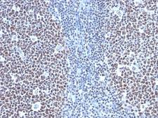 CCNB1 / Cyclin B1 Antibody - Formalin-fixed, paraffin-embedded human tonsil stained with CCNB1 antibody (SPM619).  This image was taken for the unmodified form of this product. Other forms have not been tested.
