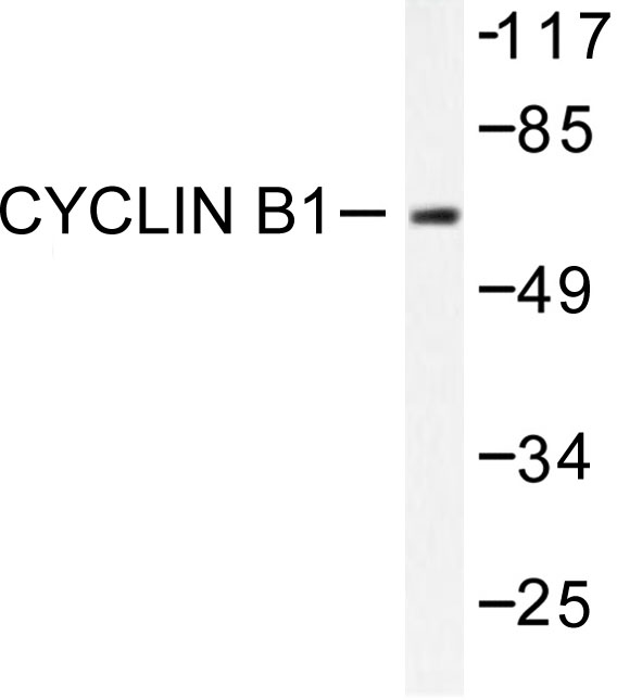 CCNB1 / Cyclin B1 Antibody - Western blot of Cyclin B1 (I120) pAb in extracts from HeLa cells treated with serum 10% 15' HepG2.