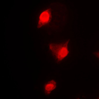 CCNB1 / Cyclin B1 Antibody - Immunofluorescent analysis of Cyclin B1 staining in K562 cells. Formalin-fixed cells were permeabilized with 0.1% Triton X-100 in TBS for 5-10 minutes and blocked with 3% BSA-PBS for 30 minutes at room temperature. Cells were probed with the primary antibody in 3% BSA-PBS and incubated overnight at 4 C in a humidified chamber. Cells were washed with PBST and incubated with a DyLight 594-conjugated secondary antibody (red) in PBS at room temperature in the dark. DAPI was used to stain the cell nuclei (blue).