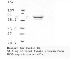 CCNB1 / Cyclin B1 Antibody - Western blot analysis using Anti-Cyclin B1 antibody shows detection of human Cyclin B1 present in asynchronous HN30 cell lysates. HN30 cells are from head and neck cancer tumors that over express cyclin B1 and D1. Comparison to a molecular weight marker indicates a band of ~62 kD corresponding to the expected molecular weight for the protein (arrowhead). The blot was incubated with a 1:500 dilution of the antibody for 1 h at room temperature. Detection occurred using a 1:10000 of HRP conjugated Goat-a-Rabbit IgG LS-C60865 and chemiluminescence reagent with a 1-min exposure time. Other detection systems will yield similar results.