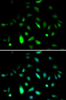 CCNB1 / Cyclin B1 Antibody - Immunofluorescence analysis of A549 cells.