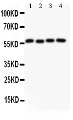 CCNB1 / Cyclin B1 Antibody - Western blot testing of Cyclin B1 antibody (0.5ug/ml) and Lane 1: HeLa; 2: 293T; 3: MCF-7; 4: COLO320 lysate