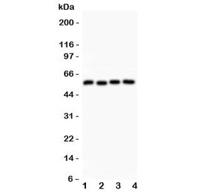 CCNB1 / Cyclin B1 Antibody - Western blot testing of Cyclin B1 antibody and Lane 1: HeLa; 2: 293T; 3: MCF-7; 4: COLO320 lysate. Predicted molecular weight: 48-60 kDa