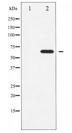 CCNB1 / Cyclin B1 Antibody - Western blot of Cyclin B1 expression in UV treated Jurkat whole cell lysates,The lane on the left is treated with the antigen-specific peptide.