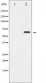 CCNB1 / Cyclin B1 Antibody - Western blot analysis of Cyclin B1 expression in serum treated HeLa whole cells lysates. The lane on the left is treated with the antigen-specific peptide.