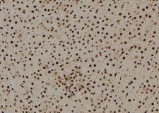CCNB1 / Cyclin B1 Antibody - 1:100 staining rat liver tissue by IHC-P. The sample was formaldehyde fixed and a heat mediated antigen retrieval step in citrate buffer was performed. The sample was then blocked and incubated with the antibody for 1.5 hours at 22°C. An HRP conjugated goat anti-rabbit antibody was used as the secondary.