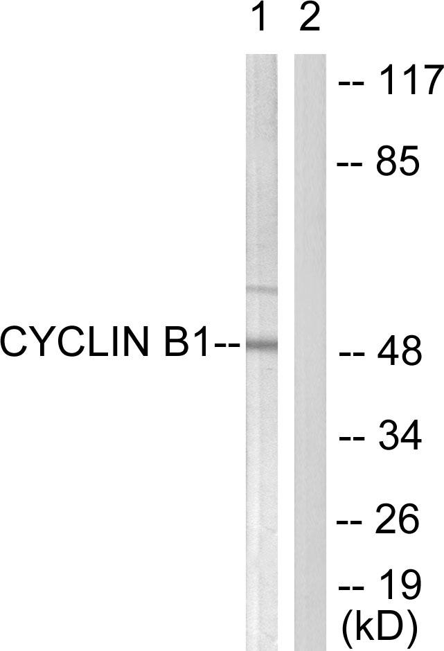 CCNB1 / Cyclin B1 Antibody - Western blot analysis of extracts from HeLa cells, treated with serum (10%, 15min), using Cyclin B1 (Ab-126) antibody ( Line 1 and 2).