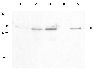 CCNB1 / Cyclin B1 Antibody - Anti-Cyclin B1 pS126 Antibody - Western Blot. Western blot of Affinity Purified anti-Cyclin B1 pS126 antibody shows detection of a band ~48 kD corresponding to phosphorylated human Cyclin B1 (arrowheads) in various whole cell lysates. Lysates tested were lane 1 - HeLa (cervical carcinoma), lane 2 - H23 (lung carcinoma), lane 3 - Hep3b (Hepatocarcinoma), lane 4 - T98G (Glioblastoma) and lane 5 - Daudi (B cell lymphoblast). Each lane contains approximately 50 ug of lysates, separated by 12% SDS-PAGE using a 5% stack run at 100 volts until the dye front cleared the bottom of the gel. Transfer occurred overnight at 4C at 15 mAmps. The membrane was blocked with 5% non-fat dry milk in TTBS for 1 h at room temperature followed by addition of a 1:100 dilution of the antibody allowed to react for 2h at room temperature. After washes with TTBS a 1:5000 dilution of HRP conjugated Gt-a-Rabbit IgG [H&L] MX (LS-C60865) was added for 1 h at room temperature. After additional washes the membrane was incubated with ECL mix 1:1 for ~3 min. Excess detection solution was drained off and the membrane was exposed to Kodak film Xomat blue XB-1 for about 20 sec. Other detection systems will yield similar results. Personal Communication, Luca Cote, Temple U.