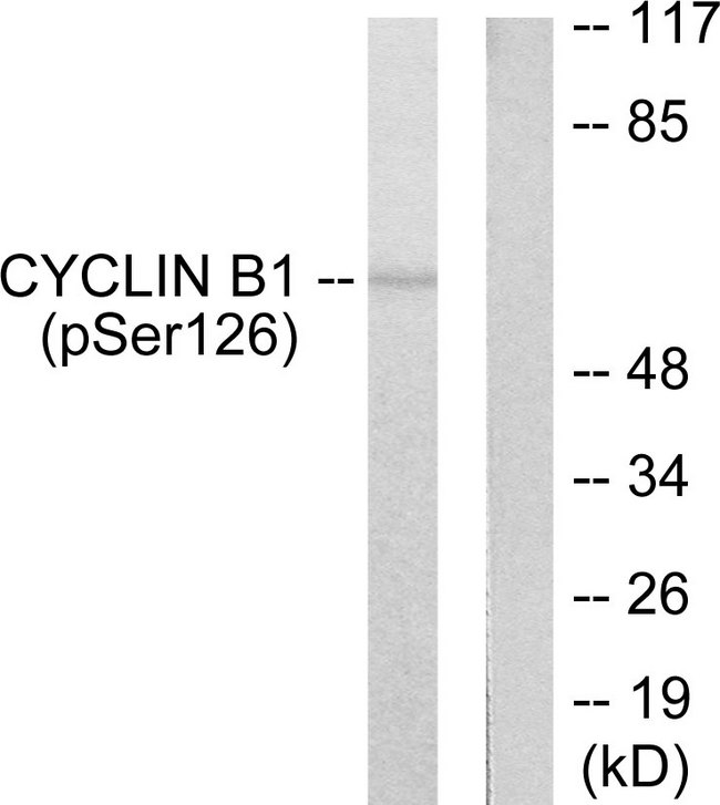 CCNB1 / Cyclin B1 Antibody - Western blot analysis of lysates from NIH/3T3 cells treated with EGF 200ng/ml 15', using Cyclin B1 (Phospho-Ser126) Antibody. The lane on the right is blocked with the phospho peptide.