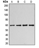CCNB1 / Cyclin B1 Antibody - Western blot analysis of Cyclin B1 (pS126) expression in HT29 nocodazole-treated (A); Jurkat (B); HeLa (C); Raw264.7 (D) whole cell lysates.