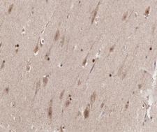 CCNB1 / Cyclin B1 Antibody - 1:200 staining human brain tissue by IHC-P. The tissue was formaldehyde fixed and a heat mediated antigen retrieval step in citrate buffer was performed. The tissue was then blocked and incubated with the antibody for 1.5 hours at 22°C. An HRP conjugated goat anti-rabbit antibody was used as the secondary.