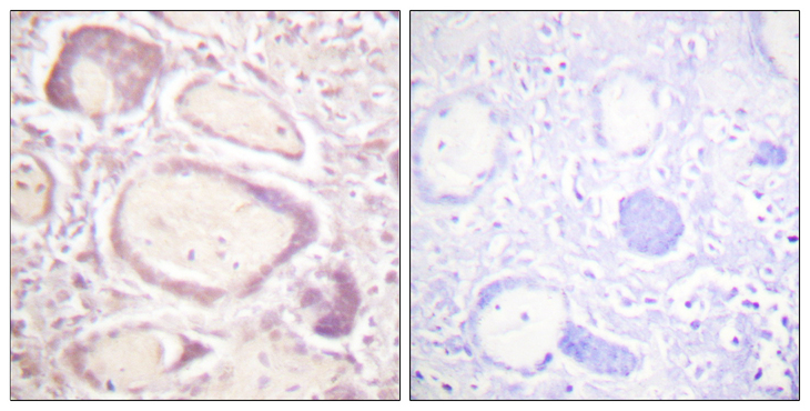 CCNB1 / Cyclin B1 Antibody - Immunohistochemistry analysis of paraffin-embedded human placenta, using Cyclin B1 (Phospho-Ser147) Antibody. The picture on the right is blocked with the phospho peptide.