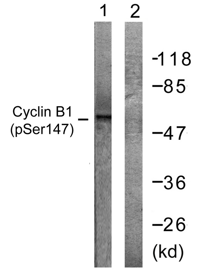 CCNB1 / Cyclin B1 Antibody - Western blot analysis of lysates from Jurkat cells treated with UV 15', using Cyclin B1 (Phospho-Ser147) Antibody. The lane on the right is blocked with the phospho peptide.