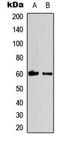 CCNB1 / Cyclin B1 Antibody - Western blot analysis of Cyclin B1 (pS147) expression in MDA anisomycin-treated (A); HeLa UV-treated (B) whole cell lysates.