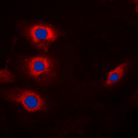 CCNB1 / Cyclin B1 Antibody - Immunofluorescent analysis of Cyclin B1 (pS147) staining in HeLa cells. Formalin-fixed cells were permeabilized with 0.1% Triton X-100 in TBS for 5-10 minutes and blocked with 3% BSA-PBS for 30 minutes at room temperature. Cells were probed with the primary antibody in 3% BSA-PBS and incubated overnight at 4 ??C in a humidified chamber. Cells were washed with PBST and incubated with a DyLight 594-conjugated secondary antibody (red) in PBS at room temperature in the dark. DAPI was used to stain the cell nuclei (blue).