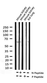 CCNB1 / Cyclin B1 Antibody - Western blot analysis of Phospho-Cyclin B1 (Ser147) expression in various lysates