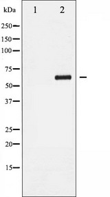 CCNB1 / Cyclin B1 Antibody - Western blot analysis of Cyclin B1 phosphorylation expression in UV treated Jurkat whole cells lysates. The lane on the left is treated with the antigen-specific peptide.
