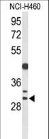 CCNB1IP1 Antibody - Western blot of CCNB1IP1 Antibody in NCI-H460 cell line lysates (35 ug/lane). CCNB1IP1 (arrow) was detected using the purified antibody.