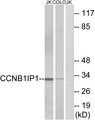 CCNB1IP1 Antibody - Western blot analysis of lysates from Jurkat and COLO cells, using CCNB1IP1 Antibody. The lane on the right is blocked with the synthesized peptide.