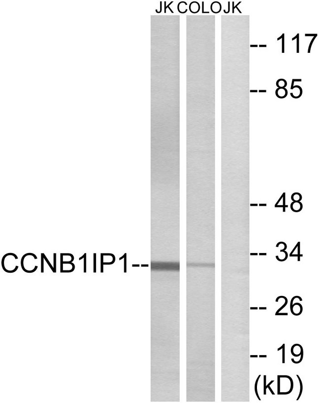 CCNB1IP1 Antibody - Western blot analysis of lysates from Jurkat and COLO cells, using CCNB1IP1 Antibody. The lane on the right is blocked with the synthesized peptide.
