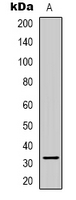 CCNB1IP1 Antibody - Western blot analysis of CCNB1IP1 expression in Jurkat (A) whole cell lysates.