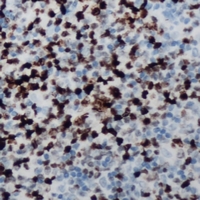 CCNB1IP1 Antibody - Immunohistochemical analysis of CCNB1IP1 staining in human lymph node formalin fixed paraffin embedded tissue section. The section was pre-treated using heat mediated antigen retrieval with sodium citrate buffer (pH 6.0). The section was then incubated with the antibody at room temperature and detected with HRP and DAB as chromogen. The section was then counterstained with hematoxylin and mounted with DPX.