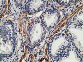 CCNB1IP1 Antibody - IHC of paraffin-embedded Human prostate tissue using anti-CCNB1IP1 mouse monoclonal antibody. (Heat-induced epitope retrieval by 10mM citric buffer, pH6.0, 100C for 10min).