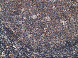 CCNB1IP1 Antibody - IHC of paraffin-embedded Human lymph node tissue using anti-CCNB1IP1 mouse monoclonal antibody. (Heat-induced epitope retrieval by 10mM citric buffer, pH6.0, 100C for 10min).