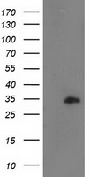 CCNB1IP1 Antibody - HEK293T cells were transfected with the pCMV6-ENTRY control (Left lane) or pCMV6-ENTRY CCNB1IP1 (Right lane) cDNA for 48 hrs and lysed. Equivalent amounts of cell lysates (5 ug per lane) were separated by SDS-PAGE and immunoblotted with anti-CCNB1IP1.
