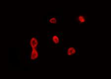 CCNB1IP1 Antibody - Staining HepG2 cells by IF/ICC. The samples were fixed with PFA and permeabilized in 0.1% Triton X-100, then blocked in 10% serum for 45 min at 25°C. The primary antibody was diluted at 1:200 and incubated with the sample for 1 hour at 37°C. An Alexa Fluor 594 conjugated goat anti-rabbit IgG (H+L) Ab, diluted at 1/600, was used as the secondary antibody.