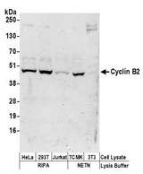 CCNB2 / Cyclin B2 Antibody - Detection of human and mouse Cyclin B2 by western blot. Samples: Whole cell lysate (50 µg) from HeLa, HEK293T, Jurkat, mouse TCMK-1, and mouse NIH 3T3 cells prepared using NETN and RIPA lysis buffer. Antibodies: Affinity purified rabbit anti-Cyclin B2 antibody used for WB at 1 µg/ml. Detection: Chemiluminescence with an exposure time of 3 minutes.