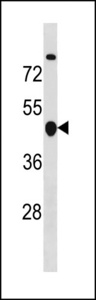 CCNB2 / Cyclin B2 Antibody - CCNB2 Antibody (Center S92/T94) western blot of MDA-MB453 cell line lysates (35 ug/lane). The CCNB2 antibody detected the CCNB2 protein (arrow).