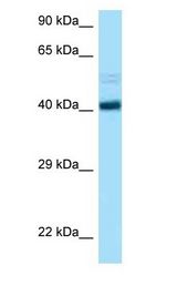 CCNB2 / Cyclin B2 Antibody - CCNB2 / Cyclin B2 antibody Western Blot of NCI-H226.  This image was taken for the unconjugated form of this product. Other forms have not been tested.