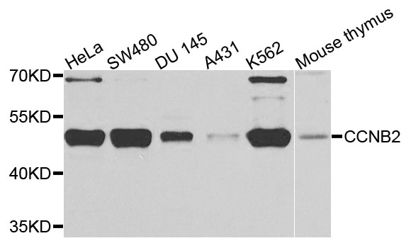 CCNB2 / Cyclin B2 Antibody - Western blot analysis of extracts of various cells.