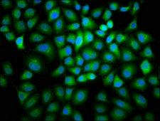 CCNB2 / Cyclin B2 Antibody - Immunofluorescence staining of Hela cells with CCNB2 Antibody at 1:166, counter-stained with DAPI. The cells were fixed in 4% formaldehyde, permeabilized using 0.2% Triton X-100 and blocked in 10% normal Goat Serum. The cells were then incubated with the antibody overnight at 4°C. The secondary antibody was Alexa Fluor 488-congugated AffiniPure Goat Anti-Rabbit IgG(H+L).