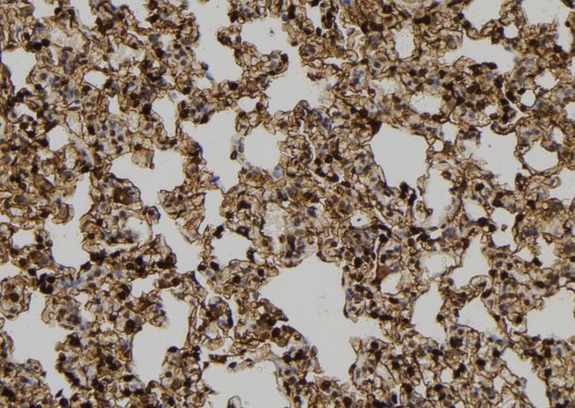 CCNB2 / Cyclin B2 Antibody - 1:100 staining rat lung tissue by IHC-P. The sample was formaldehyde fixed and a heat mediated antigen retrieval step in citrate buffer was performed. The sample was then blocked and incubated with the antibody for 1.5 hours at 22°C. An HRP conjugated goat anti-rabbit antibody was used as the secondary.