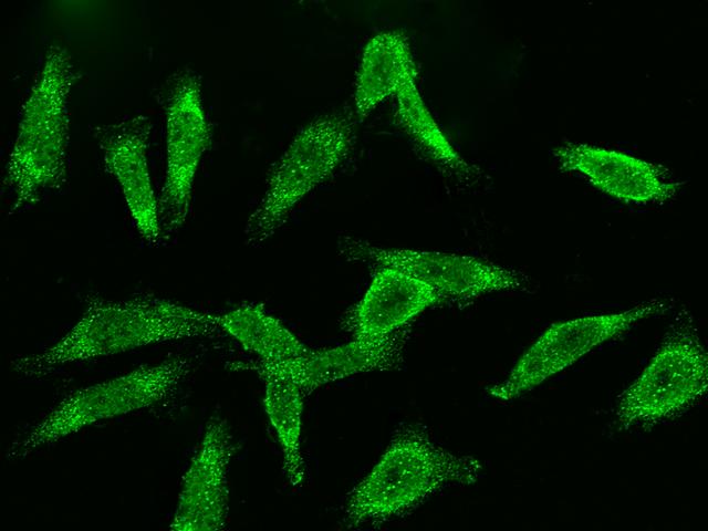 CCNB2 / Cyclin B2 Antibody - Immunofluorescence staining of CCNB2 in SW480 cells. Cells were fixed with 4% PFA, permeabilzed with 0.3% Triton X-100 in PBS, blocked with 10% serum, and incubated with rabbit anti-Human CCNB2 polyclonal antibody (dilution ratio 1:1000) at 4°C overnight. Then cells were stained with the Alexa Fluor 488-conjugated Goat Anti-rabbit IgG secondary antibody (green). Positive staining was localized to cytoplasm.