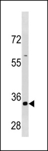 CCNB3 / Cyclin B3 Antibody - CCNB3 Antibody (C-term S1331/S1333) western blot of HepG2 cell line lysates (35 ug/lane). The CCNB3 antibody detected the CCNB3 protein (arrow).