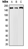 CCNB3 / Cyclin B3 Antibody - Western blot analysis of Cyclin B3 expression in A549 (A); Raw264.7 (B); PC12 (C) whole cell lysates.