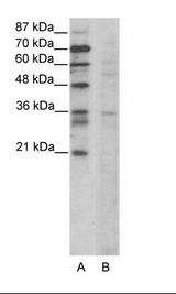 CCNB3 / Cyclin B3 Antibody - A: Marker, B: Jurkat Cell Lysate.  This image was taken for the unconjugated form of this product. Other forms have not been tested.