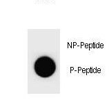 CCNB3 / Cyclin B3 Antibody - Dot blot of Mouse CCNB3 Antibody (Phospho S1063) Phospho-specific antibody on nitrocellulose membrane. 50ng of Phospho-peptide or Non Phospho-peptide per dot were adsorbed. Antibody working concentrations are 0.6ug per ml.
