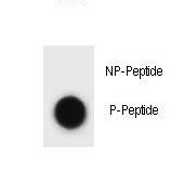 CCNB3 / Cyclin B3 Antibody - Dot blot of mouse CCNB3 Antibody (Phospho T257) Phospho-specific antibody on nitrocellulose membrane. 50ng of Phospho-peptide or Non Phospho-peptide per dot were adsorbed. Antibody working concentrations are 0.6ug per ml.
