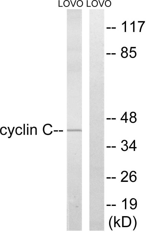 CCNC / Cyclin C Antibody - Western blot analysis of lysates from LOVO cells, using Cyclin C Antibody. The lane on the right is blocked with the synthesized peptide.