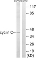 CCNC / Cyclin C Antibody - Western blot analysis of lysates from LOVO cells, using Cyclin C Antibody. The lane on the right is blocked with the synthesized peptide.
