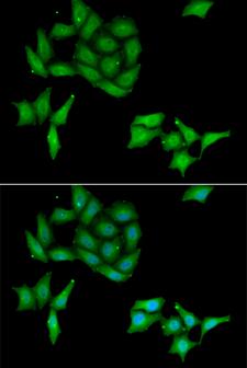 CCNC / Cyclin C Antibody - Immunofluorescence analysis of HeLa cells.