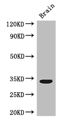 CCNC / Cyclin C Antibody - Positive WB detected in:Mouse brain tissue;All lanes: CCNC antibody at 3ug/ml;Secondary;Goat polyclonal to rabbit IgG at 1/50000 dilution;Predicted band size: 34,23 kDa;Observed band size: 34 kDa;