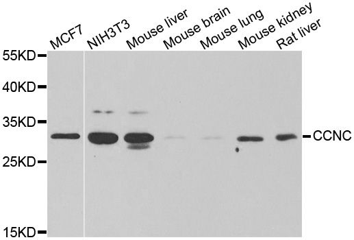 CCNC / Cyclin C Antibody - Western blot analysis of extracts of various cell lines, using CCNC antibody at 1:1000 dilution. The secondary antibody used was an HRP Goat Anti-Rabbit IgG (H+L) at 1:10000 dilution. Lysates were loaded 25ug per lane and 3% nonfat dry milk in TBST was used for blocking. An ECL Kit was used for detection and the exposure time was 60s.