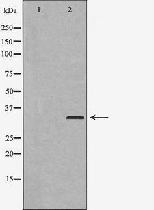CCNC / Cyclin C Antibody - Western blot analysis of Cyclin C expression in LOVO cells. The lane on the left is treated with the antigen-specific peptide.