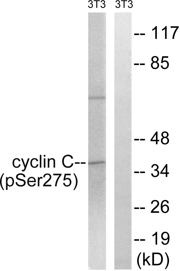 CCNC / Cyclin C Antibody - Western blot analysis of lysates from NIH/3T3 cells treated with UV 15', using Cyclin C (Phospho-Ser275) Antibody. The lane on the right is blocked with the phospho peptide.